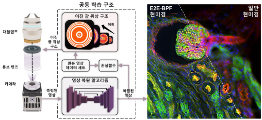 주철민 연세대 교수 연구팀은 딥러닝 기반 고심도 산술 영상 플랫폼인 'E2E-BPF 현미경'을 개발했다. 사진은 현미경 시스템의 개념도  주철민 교수 제공